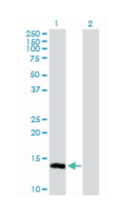 ubiquitin-conjugating enzyme E2L 6, Rabbit, Purified MaxPab Polyclonal