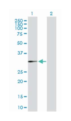dehydrogenase/reductase (SDR family) member 3, Mouse, Purified MaxPab&trade; Polyclonal Antibody, Abnova&trade;