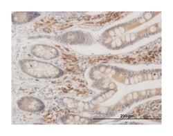mitogen-activated protein kinase-activated protein kinase 2, Mouse, Clone:
