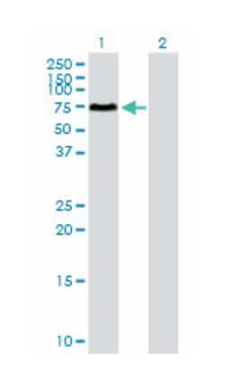 SOCS6, Mouse, Purified MaxPab Polyclonal Antibody, Abnova 50 &mu;g | Buy Online | Abnova Corporation | Fisher Scientific