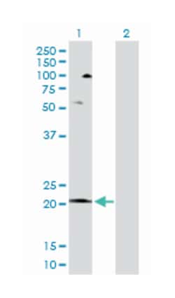 COX5A, Rabbit, Purified MaxPab Polyclonal Antibody, Abnova 100&mu;g; Unlabeled:Antibodies,