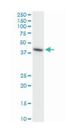 HS6ST1, Mouse, Clone: 1H4, Abnova 200&mu;L; Unlabeled:Antibodies, Monoclonal