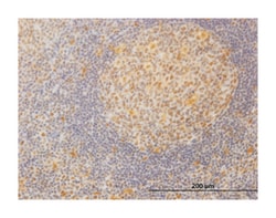 mediator complex subunit 21, Mouse, Clone: 3E9, Abnova 100&mu;g; Unlabeled:Antibodies,