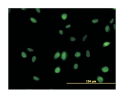 mediator complex subunit 21, Mouse, Clone: 3E9, Abnova 100&mu;g; Unlabeled:Antibodies,