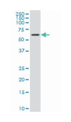 cytochrome P450, family 7, subfamily B, polypeptide 1, Mouse, Polyclonal