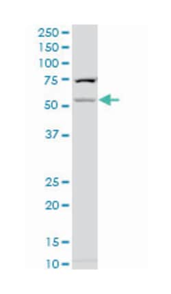 carbohydrate (N-acetylglucosamine-6-O) sulfotransferase 2, Mouse, Polyclonal