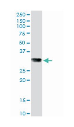 glutathione S-transferase omega 1 (B01), Mouse anti-Human, Mouse, Rat,