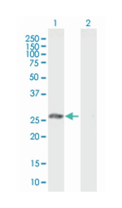glutathione S-transferase omega 1 (B01), Mouse anti-Human, Mouse, Rat,