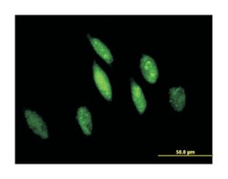glutathione S-transferase omega 1 (B01), Mouse anti-Human, Mouse, Rat,