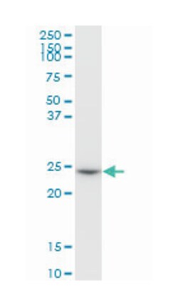 GSTO1, Mouse, Purified MaxPab Polyclonal Antibody, Abnova 50&mu;g; Unlabeled:Antibodies,