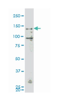 mitogen-activated protein kinase kinase kinase kinase 4, Mouse, Clone: