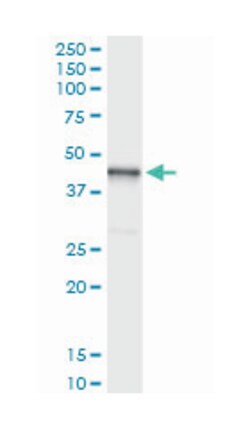 HOMER2, Rabbit, MaxPab Polyclonal Antibody, Abnova 100&mu;L; Unlabeled:Antibodies,