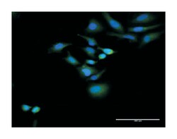 HOMER2, Rabbit, MaxPab Polyclonal Antibody, Abnova 100&mu;L; Unlabeled:Antibodies,