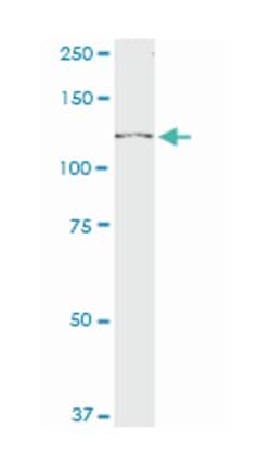 eukaryotic translation initiation factor 2-alpha kinase 3, Mouse, Polyclonal