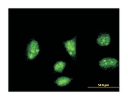 heart and neural crest derivatives expressed 2, Mouse, Clone: 3E3, Abnova