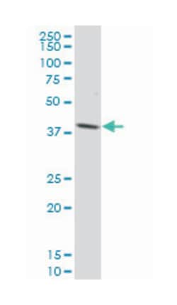 phosphate cytidylyltransferase 1, choline, beta, Mouse, Polyclonal Antibody,