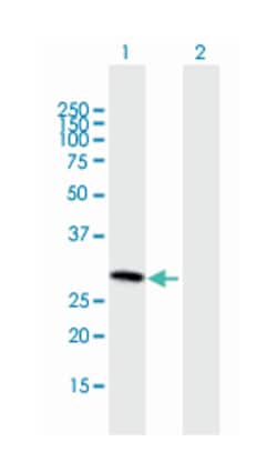 SLC25A27, Mouse, Polyclonal Antibody, Abnova 50 &mu;g | Buy Online | Abnova Corporation | Fisher Scientific