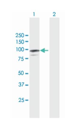 melanoma antigen family D, 1 (B01), Mouse anti-Human, Polyclonal Antibody, Abnova&trade;