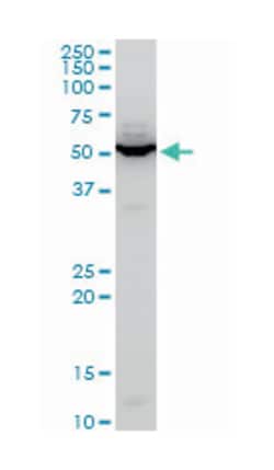 CBF1 interacting corepressor, Mouse, Polyclonal Antibody, Abnova 50&mu;L;