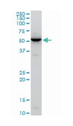 CBF1 interacting corepressor, Mouse, Polyclonal Antibody, Abnova 50&mu;L;