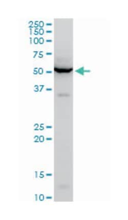 CBF1 interacting corepressor, Mouse, Polyclonal Antibody, Abnova 50&mu;L;