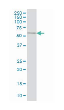 sperm associated antigen 6, Mouse, Clone: 3E3, Abnova 100&mu;g; Unlabeled:Antibodies,