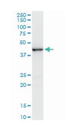 CREB5, Mouse, Clone: 1E2, Abnova 200μL; Unlabeled:Antibodies, Monoclonal