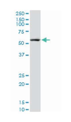 cAMP responsive element binding protein 5, Mouse, Clone: 8A5, Abnova 100&mu;g;