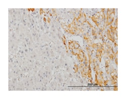 cAMP responsive element binding protein 5, Mouse, Clone: 8A5, Abnova 100&mu;g;