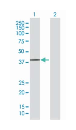 ring finger protein 14, Mouse, Polyclonal Antibody, Abnova&trade;