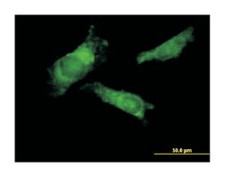 ring finger protein 14, Mouse, Polyclonal Antibody, Abnova 50&mu;L; Unlabeled:Antibodies,