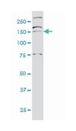 AATK, Mouse, Clone: 5B8, Abnova 200&mu;L; Unlabeled:Antibodies, Monoclonal