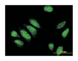 phosphodiesterase 4D interacting protein, Mouse, Polyclonal Antibody, Abnova