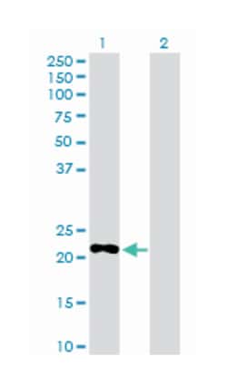 phosphodiesterase 4D interacting protein, Rabbit, Purified MaxPab Polyclonal