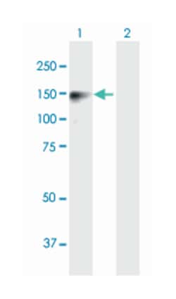 SAPS2, Mouse, Polyclonal Antibody, Abnova 50&mu;g; Unlabeled:Antibodies,