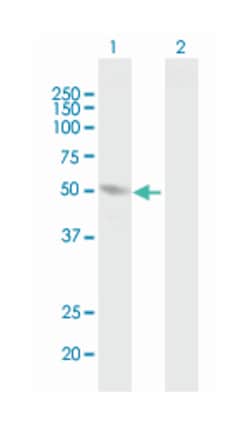 homocysteine-inducible, endoplasmic reticulum stress-inducible, ubiquitin-like domain member 1, Mouse, Polyclonal Antibody, Abnova 50 &mu;L | Buy Online | Abnova Corporation | Fisher Scientific