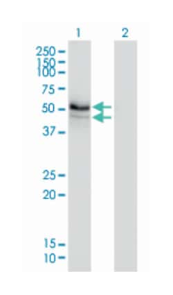 homocysteine-inducible, endoplasmic reticulum stress-inducible, ubiquitin-like