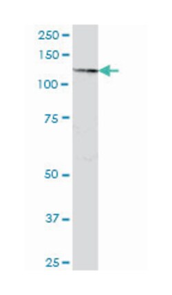 SART3, Mouse, Polyclonal Antibody, Abnova 50 &mu;g | Buy Online | Abnova Corporation | Fisher Scientific