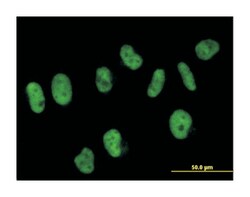 SART3, Mouse, Polyclonal Antibody, Abnova 50 &mu;g | Buy Online | Abnova Corporation | Fisher Scientific