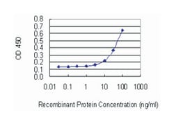 PHACTR2, Mouse, Clone: 1B12, Abnova 100 &mu;g | Buy Online | Abnova Corporation | Fisher Scientific