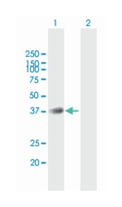 xylosylprotein beta 1,4-galactosyltransferase, polypeptide 7 (galactosyltransferase