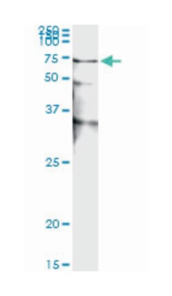 serine/threonine kinase 38, Mouse, Clone: 2G8-1F3, Abnova 100&mu;g; Unlabeled:Antibodies,