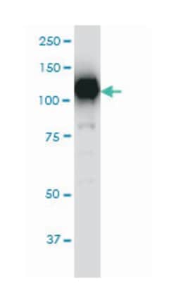sirtuin (silent mating type information regulation 2 homolog) 1 (S. cerevisiae),