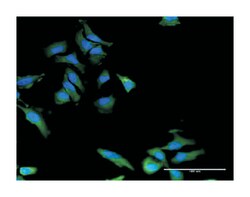 PLXNB2, Mouse, Clone: 2H3, Abnova 100 &mu;g | Buy Online | Abnova Corporation | Fisher Scientific