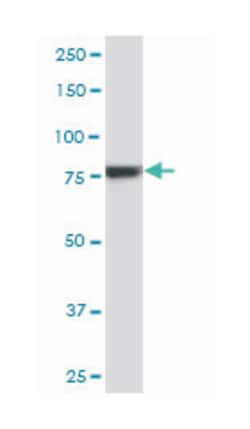 ribosomal protein S6 kinase, 90kDa, polypeptide 6, Mouse, Clone: 6F2, Abnova 100 &mu;g | Buy Online | Abnova | Fisher Scientific