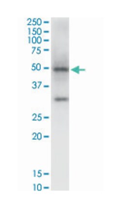 NAD(P) dependent steroid dehydrogenase-like, Mouse, Clone: 6E3, Abnova