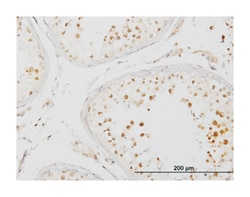 interleukin-1 receptor-associated kinase 4, Mouse, Clone: 2D3, Abnova 100 &mu;g | Buy Online | Abnova Corporation | Fisher Scientific