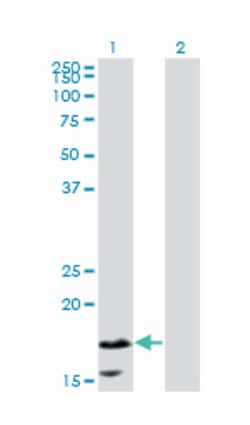 CALML5, Mouse, Clone: 2F10, Abnova 100&mu;g; Unlabeled:Antibodies, Monoclonal