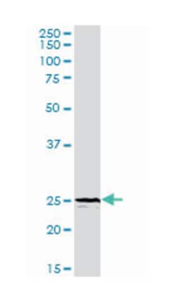 triggering receptor expressed on myeloid cells 1, Rabbit, Purified MaxPab Polyclonal Antibody, Abnova 100 &mu;g | Buy Online | Abnova | Fisher Scientific