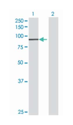 pantothenate kinase 4, Mouse, Polyclonal Antibody, Abnova 50&mu;L; Unlabeled:Antibodies,